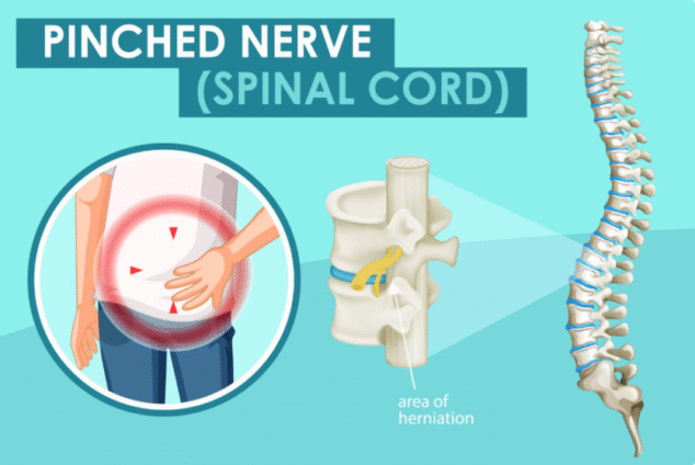 Herniated Disc & Bulging Disc Herniated Disc & Bulging Disc